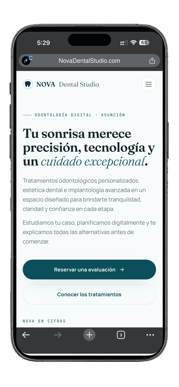 Página web de NOVA Dental Studio en celular